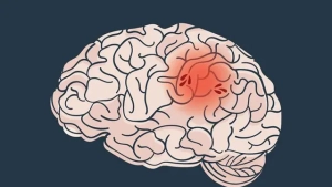 Cara Efektif Menurunkan Risiko Stroke dengan Pola Hidup Sehat 4