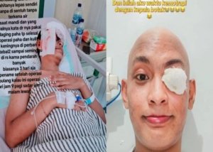 Tangkapan layar unggahan pria di Medan angkat bola mata akibat kanker (@nurdiansyahrizki07).