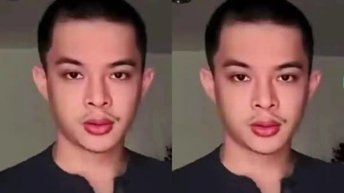 Rey Mbayang Mendadak Botak, Ini Pengakuannya Soal Penyakit Autoimun 1 Rey Mbayang Mendadak Botak, Ini Pengakuannya Soal Penyakit Autoimun